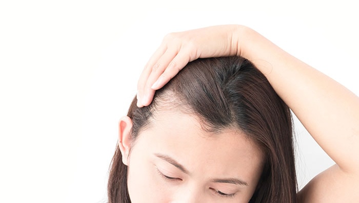 how to stop hair thinning at temples
